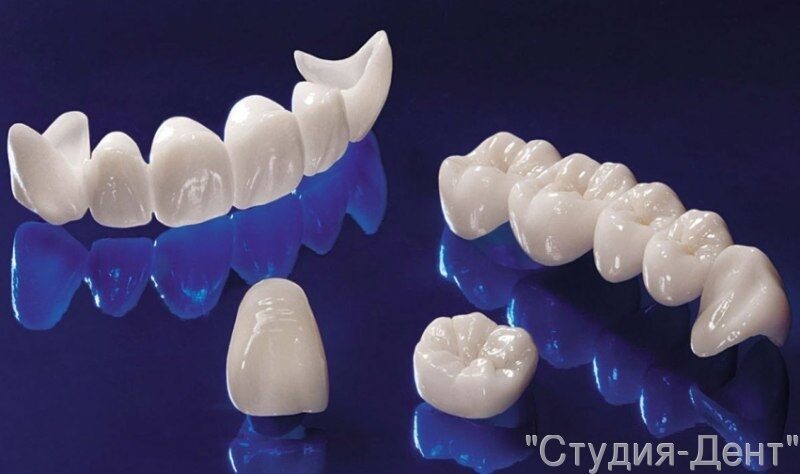 Изготовление пластмассовых коронок | зуботехническая лаборатория интердентос